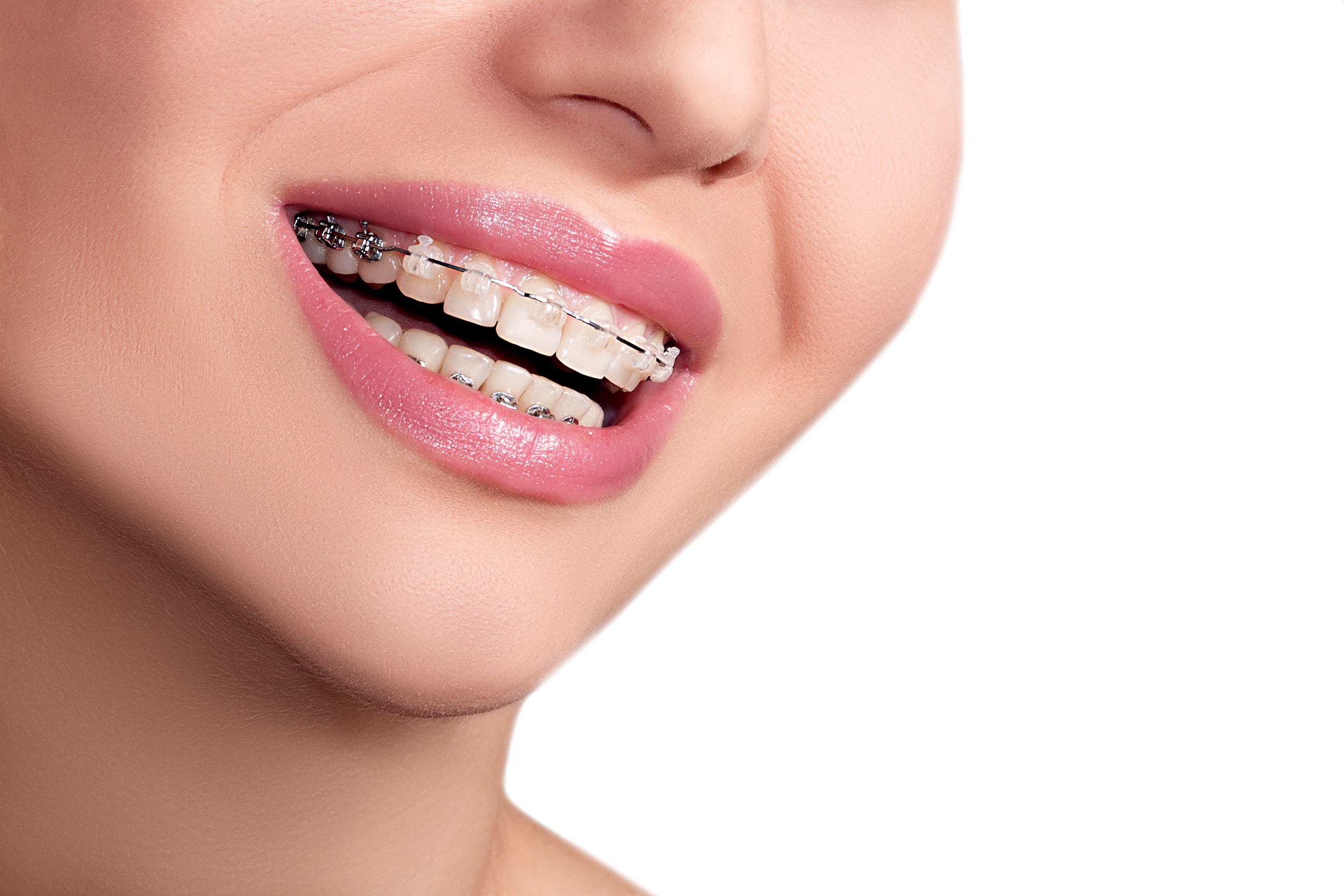 Orthodontiste montreal Clinique Rapoport et Lasry